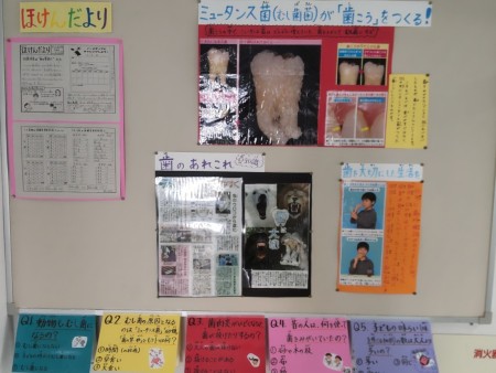 虫歯になっている歯や歯こうがついている歯の写真が掲示され、説明文が書かれている掲示板の写真