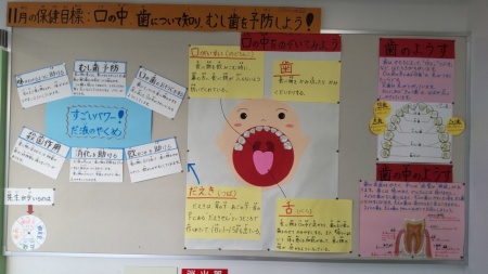 口を大きく開けている人の掲示物を使って、歯や虫歯について説明している掲示板の写真